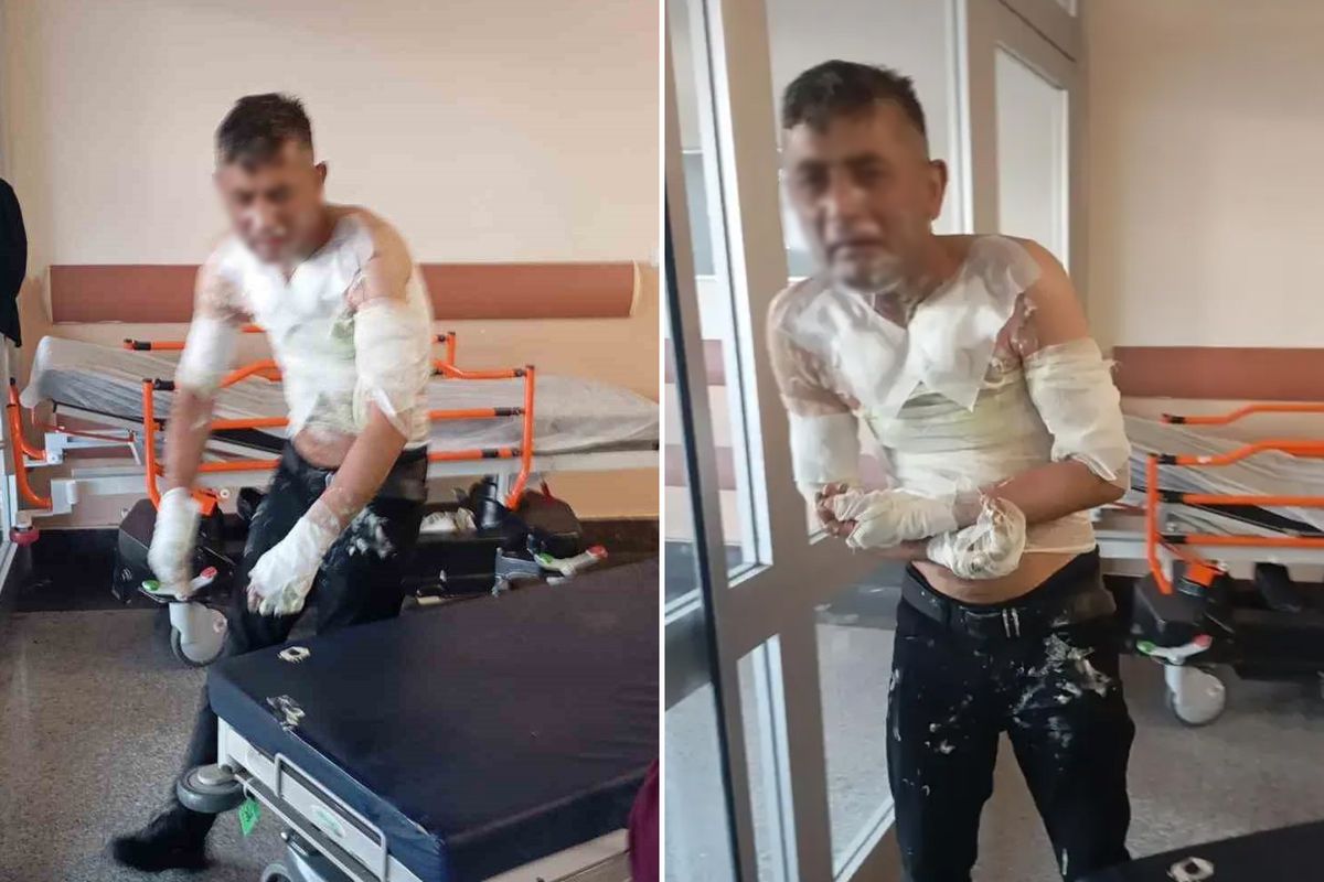 Gaziosmanpaşa’da duyma ve konuşma engeli bulunan kişinin telefonunu gasp eden ve benzin dökerek yakan sanığa 18 yıl hapis cezası