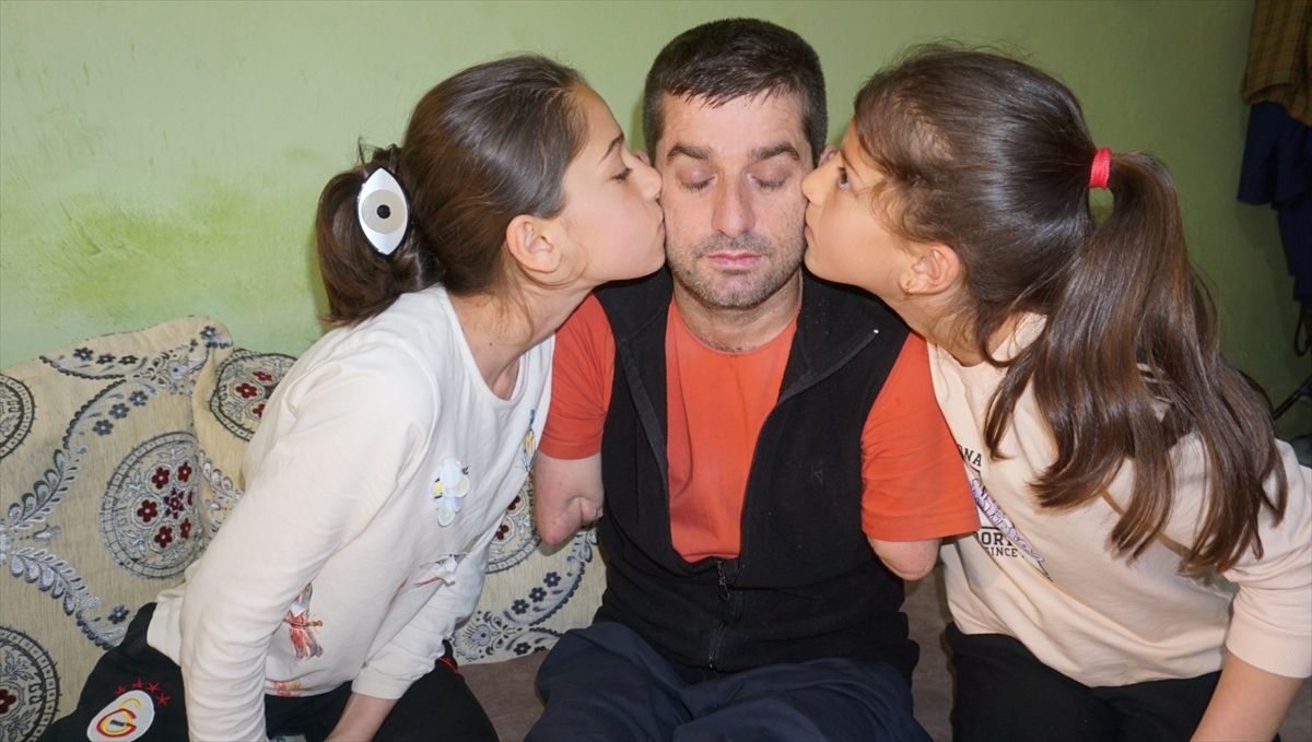 Burhan Doğruyol’un Protez Umudu