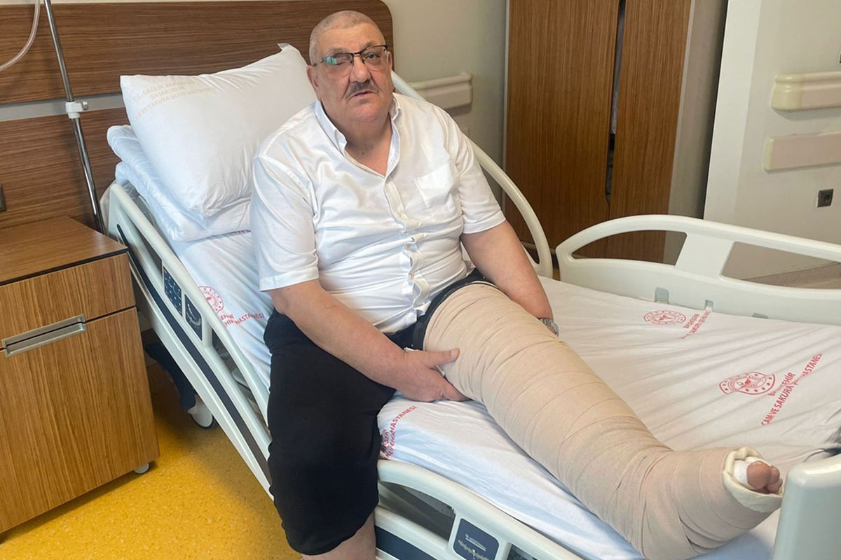 İstanbul’da fil hastasının 2 katına çıkan bacağındaki şişlik tedaviyle geriledi