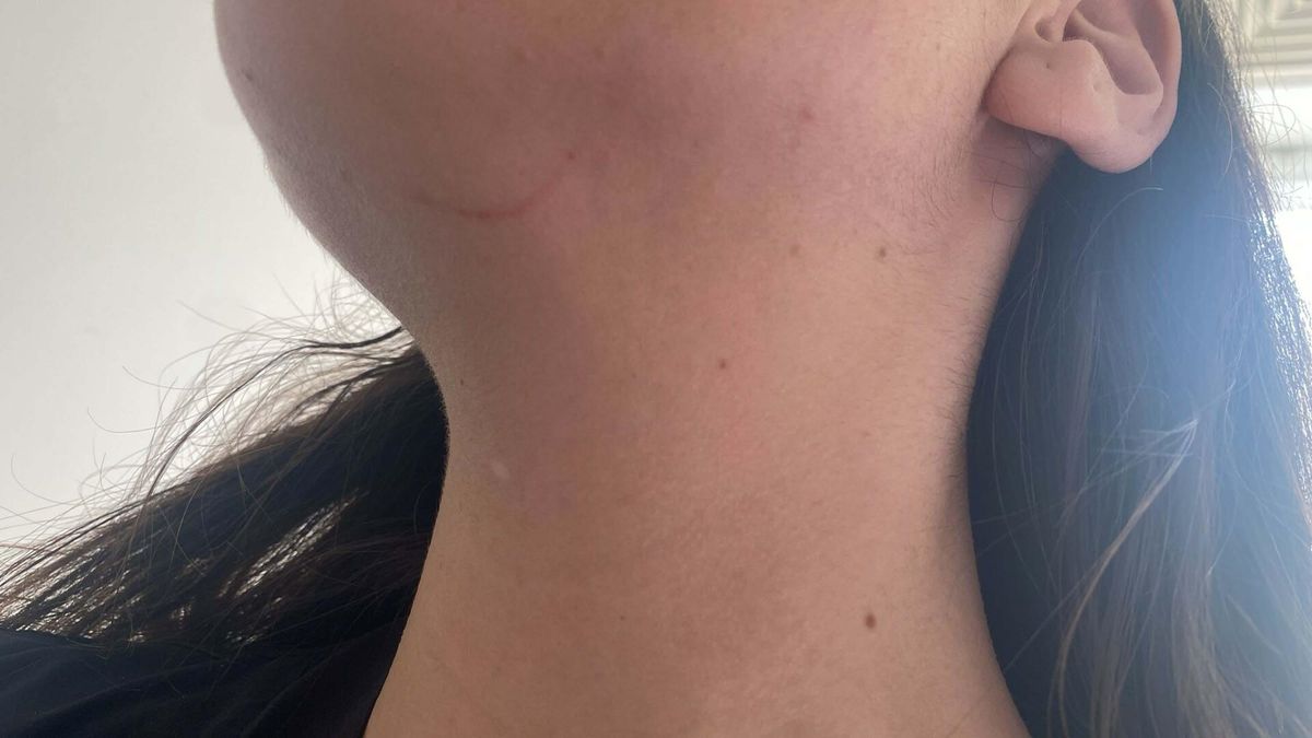 Doktor İrem Sarıkaya’ya Saldırı Davasında Ceza Kararı