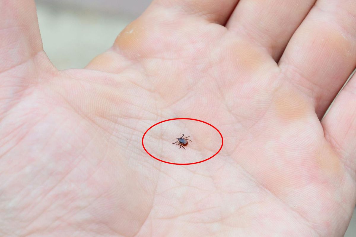 Kene vakaları artıyor, uzmanlar uyardı!