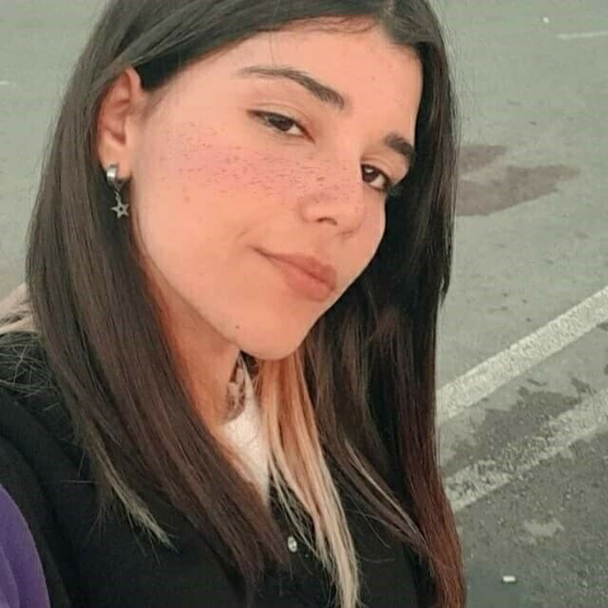 Ünzile Naz’a Acil Mama Desteği İhtiyacı